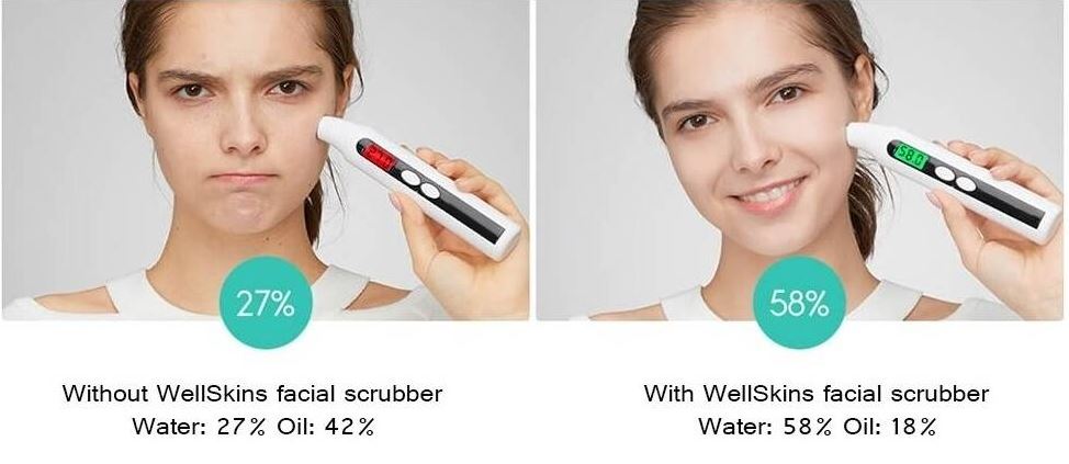 جهاز تقشير الوجه بالموجات فوق الصوتية WellSkins WX-CJ101